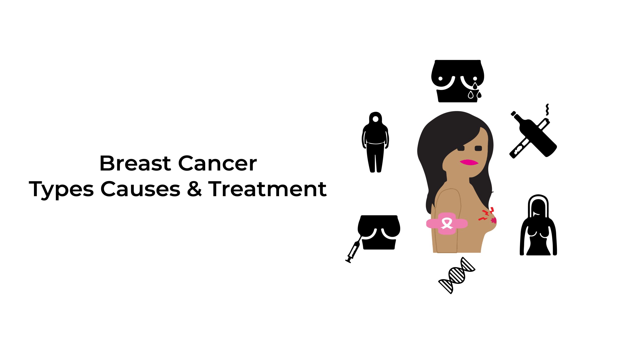 Breast-Cancer-Types-Causes-and-Treatment