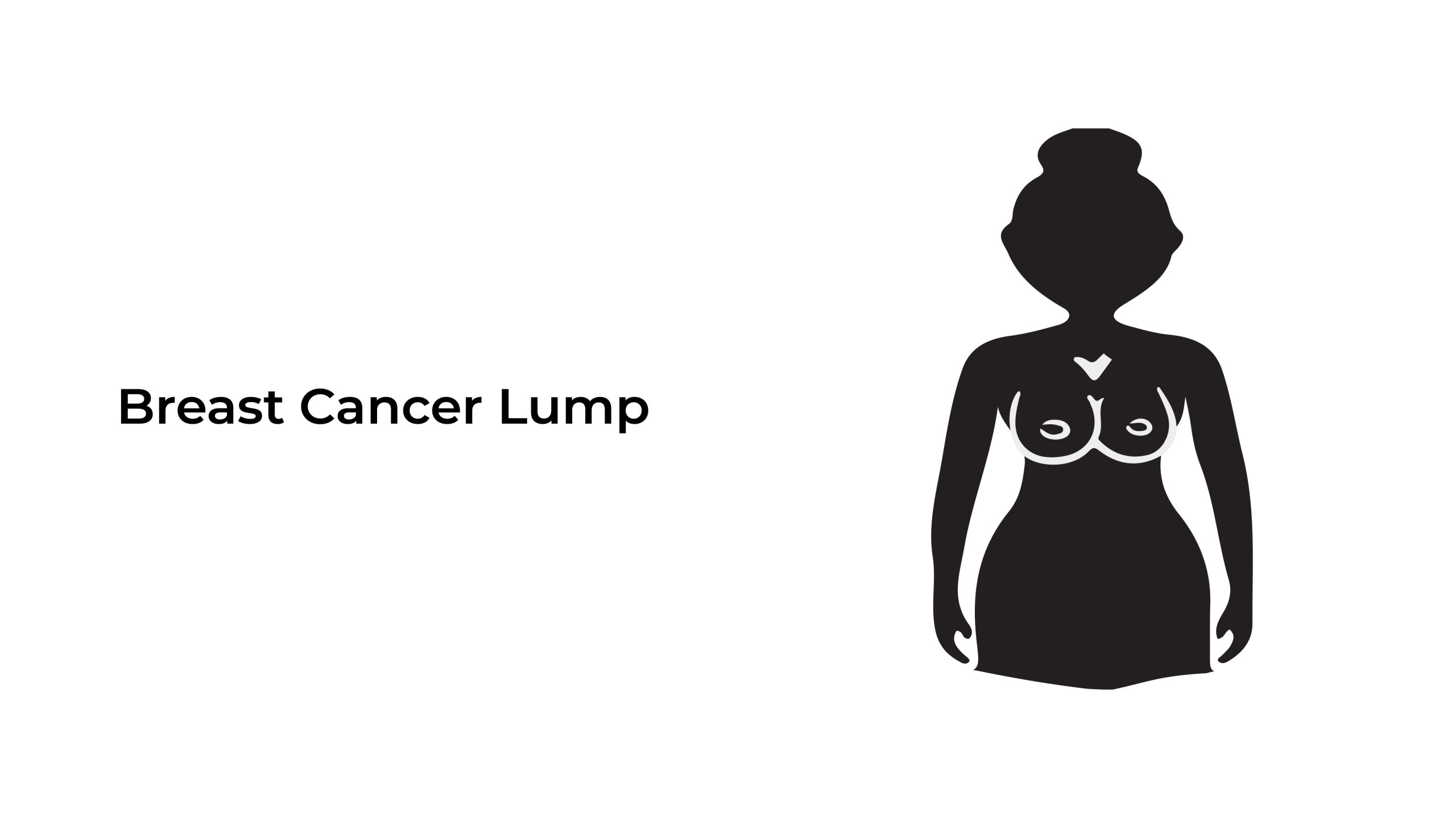 Breast-cancer-lump