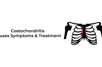 Costochondritis-Causes-Symptoms-and-Treatment