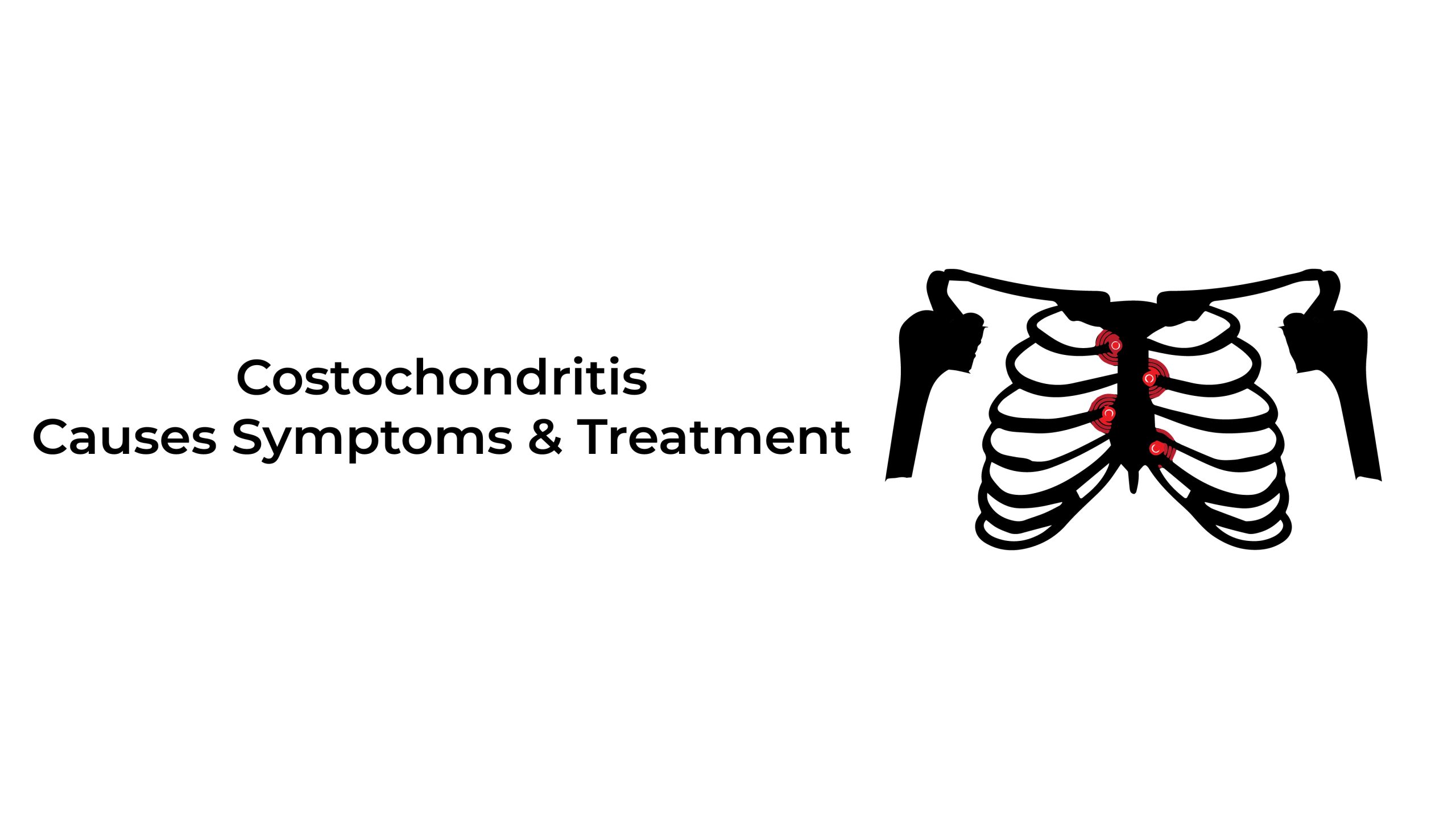 Costochondritis-Causes-Symptoms-and-Treatment