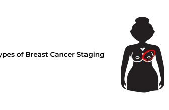 Types-of-Breast-cancer-staging