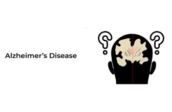 Alzheimers-Disease