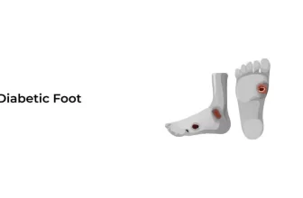 Diabetic-Foot-01-1024x576