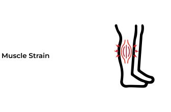 Muscle-Strain