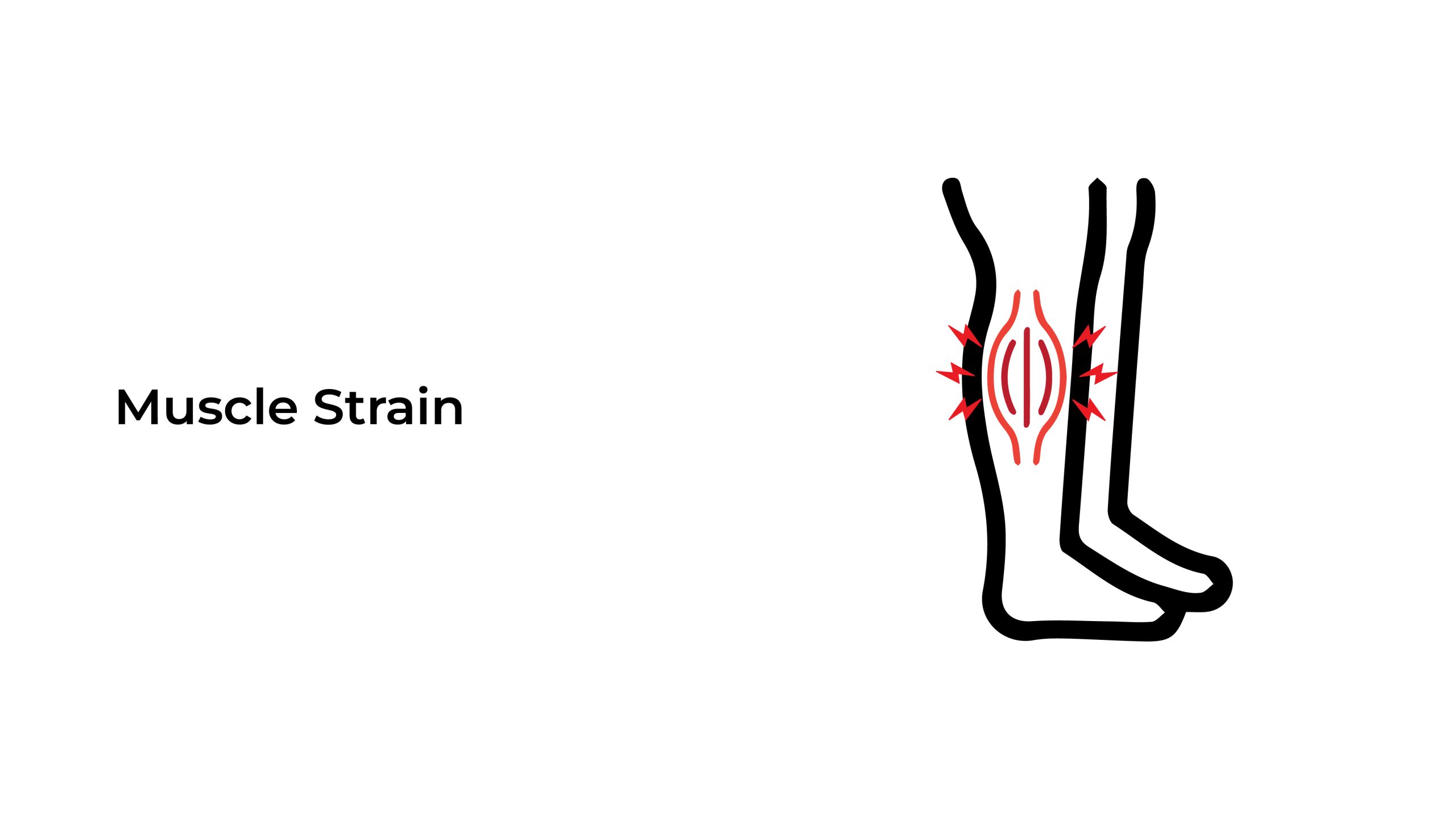 Muscle-Strain