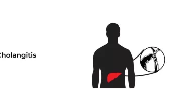 Cholangitis-01-1024x576