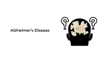 Alzheimer’s Disease
