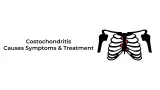 Costochondritis: Causes, Symptoms, and Treatment
