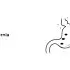 Pancreatitis