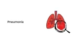 Pneumonia