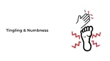 Tingling and Numbness