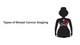 Types of Breast cancer staging
