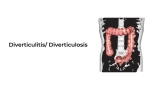Diverticulitis/ Diverticulosis