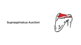 Supraspinatus Action